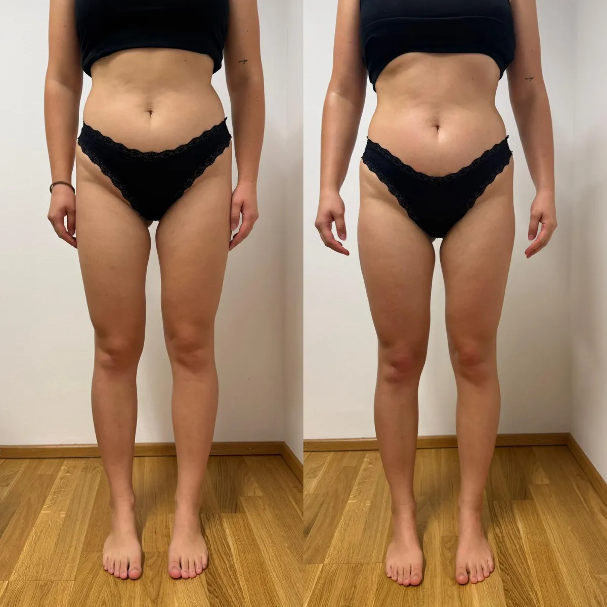 Körpervergleich von Bauch, Hüfte und Beinen in Vorderansicht